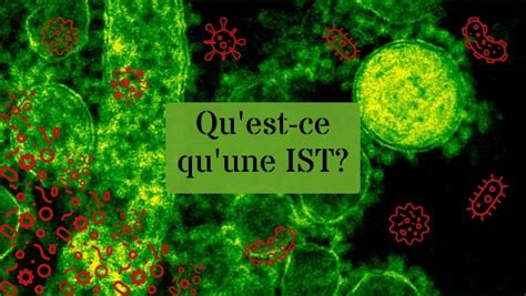 qu'est ce qu'une ist.